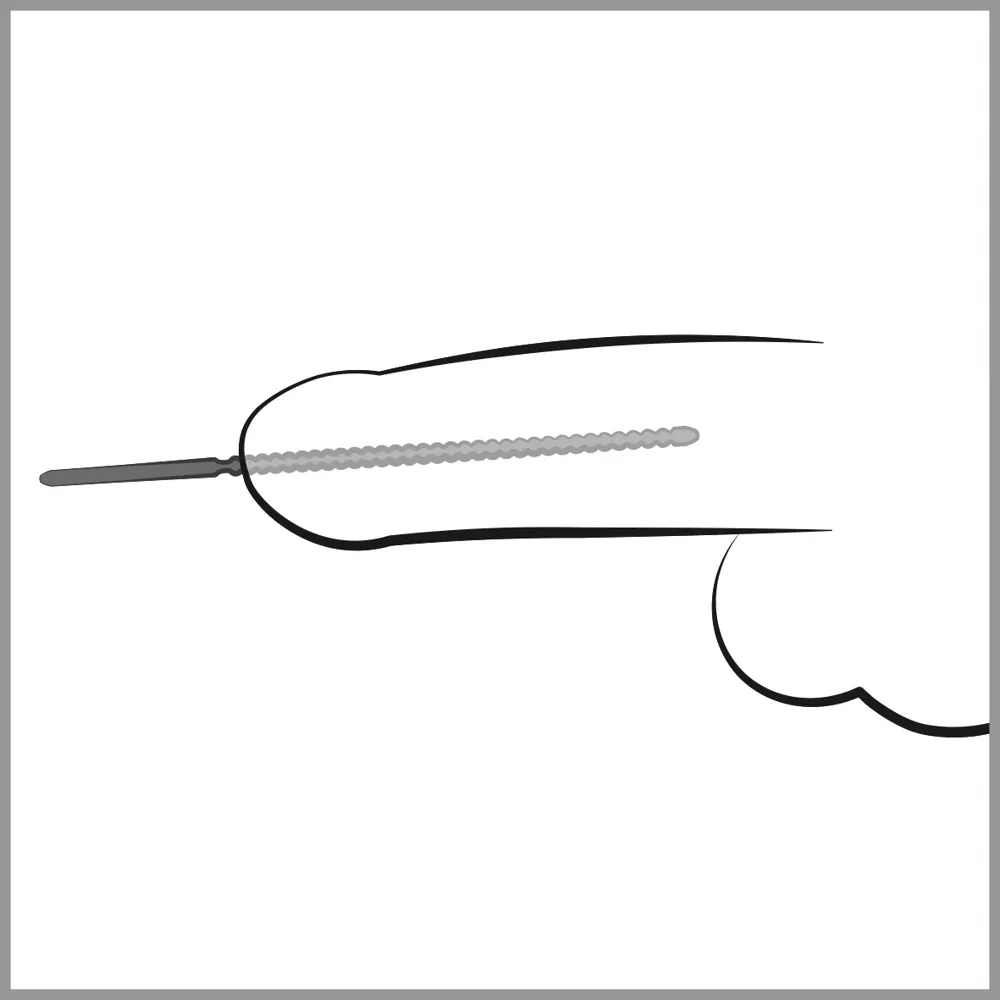 Dilatátor do močové trubice Mystim Dip Stick Ripped, nerezová ocel, 6 mm, 24 cm - obrázek 4